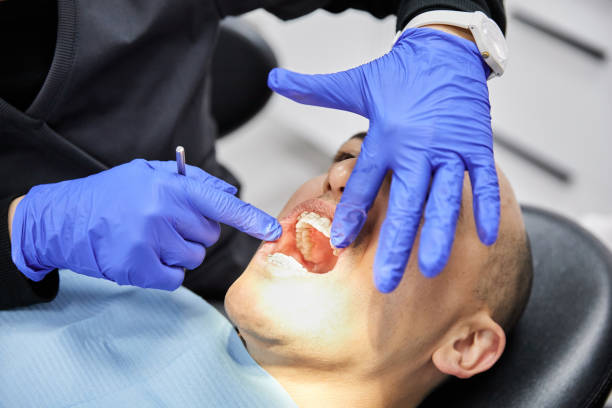 Best Knocked-Out Tooth Emergency  in Hurstbourne, KY
