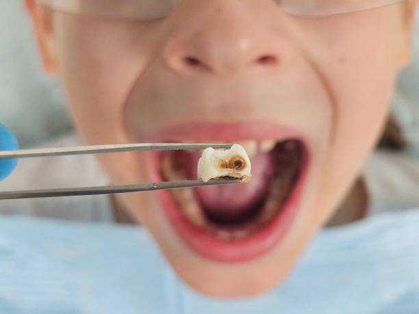 Best Tooth Infection Emergency Dentist  in Hurstbourne, KY